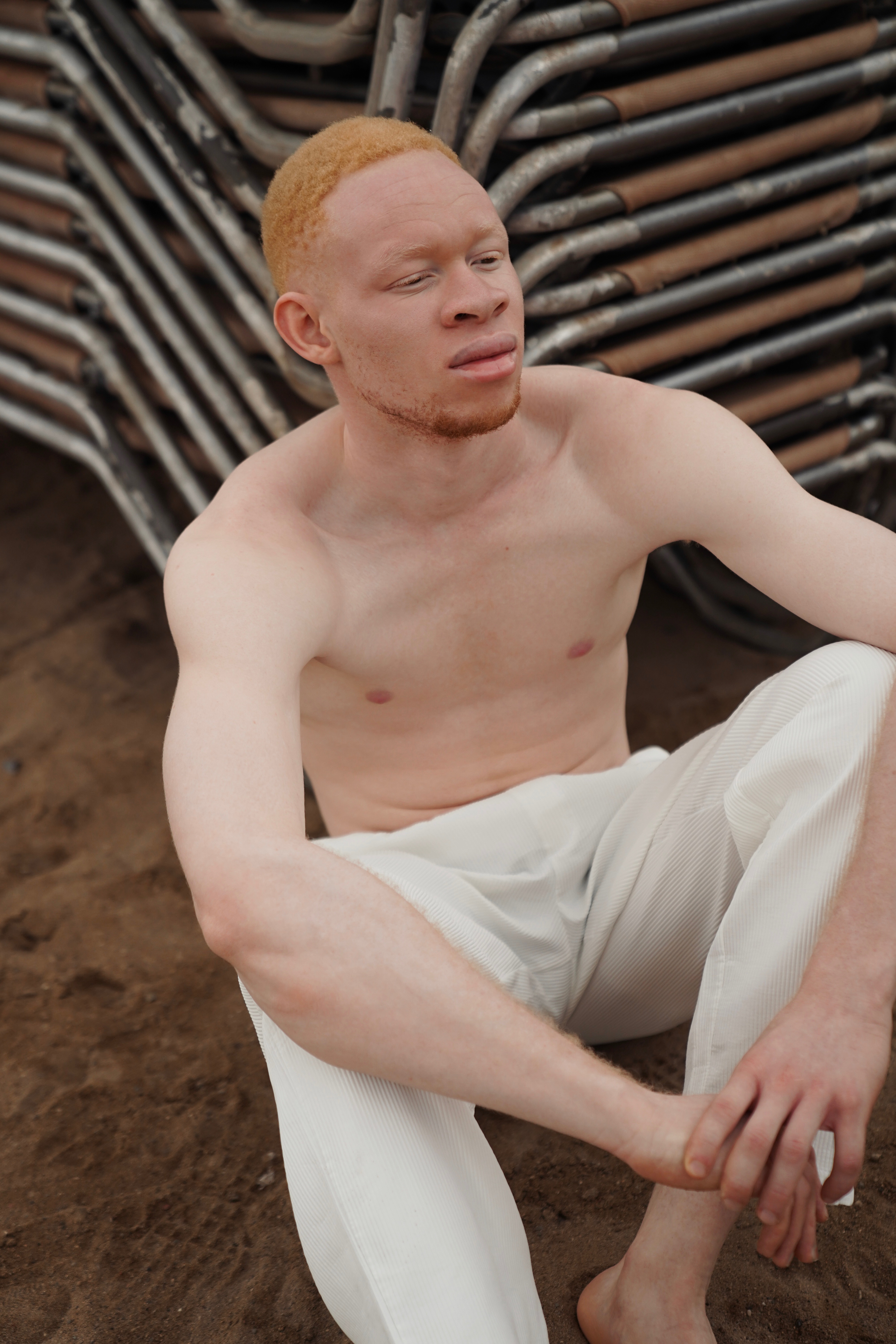 Person with albinism in white pants sitting against industrial background